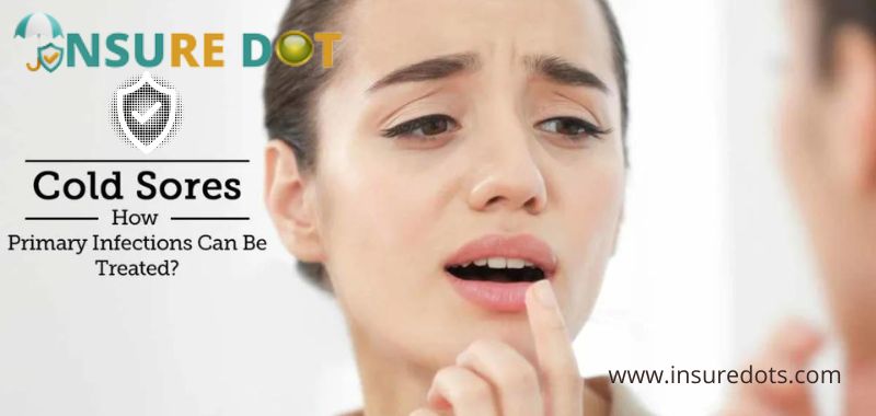 How to Protect Your Lips From Cold Sores Naturally?